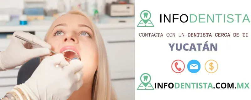 Dentista en Yucatán Dentista en Yucatán