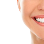 ¿Qué son las carillas dentales?