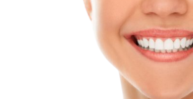 ¿Qué son las carillas dentales? ¿Qué son las carillas dentales?